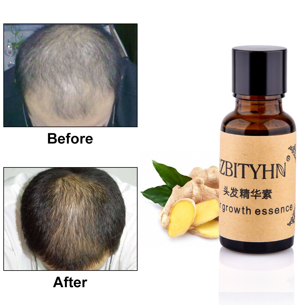 Dexe Chinese Herbal Anti Hair Loss Shampoo 200ml for sale online 