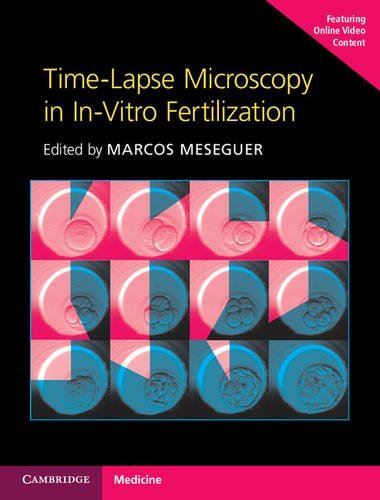 Time-Lapse Microscopy in In-Vitro Fertilization Hardback with...