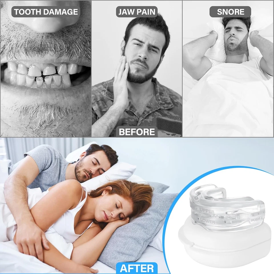 Dispositivo anti Russamento,Bite Notturno Antirussamento,Bite Dentale Notturno,R - Immagine 4 di 4