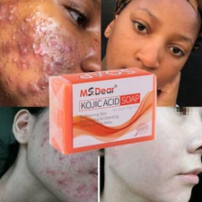 Kojic Acid Soap Dark Skin Whitening Bleaching Lightening Brightening Face & Body