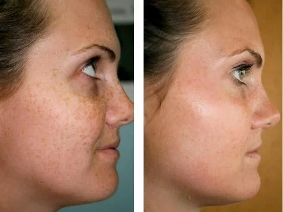 Skin Lightening Cream For Face & Body Whitening Daily Use -Free Shipping ( 50g ) - Image 4 of 4