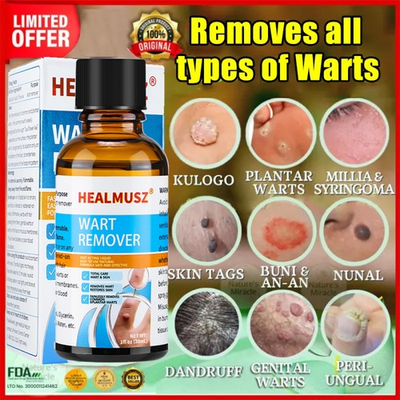 #ad #ad Wart Remover Liquid Skin Tag Mole Remover Eliminate Feet Corn Wart Remove Liquid $12.70