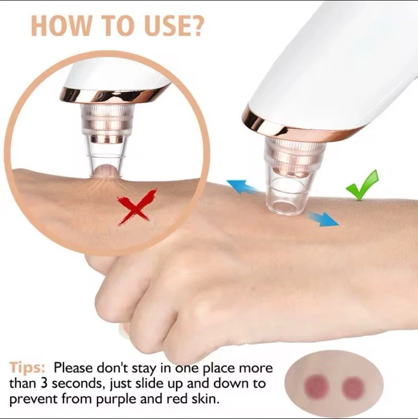 Electric Pore Cleaner - Blackhead Remover with Vacuum Cleaner + Attachments - Image 4 of 4