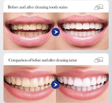 LIVFRESH Toothpaste Gel, Clinically Proven to Remove Plaque 250 Better, Impro...