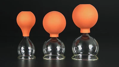 LAUSCHAER GLAS 3-piece cupping set 40-60 mm with ball, cupping glass, cupping glasses original Lauscha glass