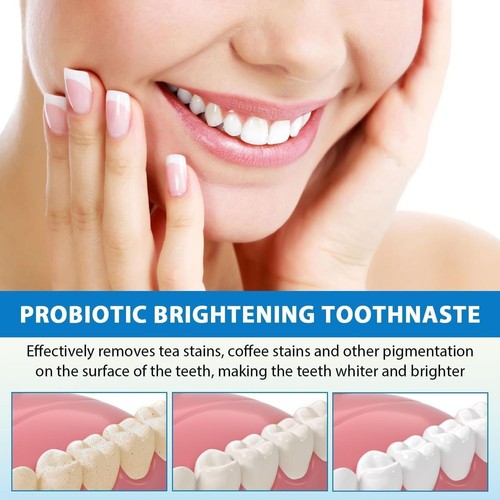 3 Packungen 140g MS DRWIKEY SP-6 Probiotic Whitening Zahnpasta MSDRWIKEY Brightening - Bild 6 von 7