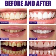 2PCS MIYANXI Teeth Whitening Powder, MIYANXI Tooth Powder Stain Rem 50g