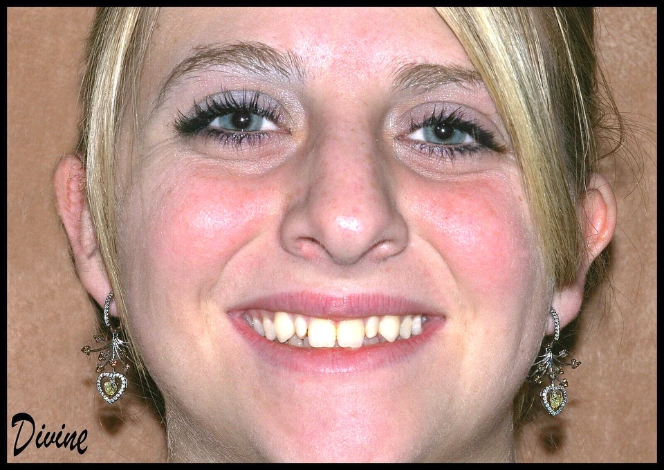 18K 心形耳环,漂亮的黄色、COGNAC 白色钻石。 雕刻,艺术装饰 — 第 3/4 张图片