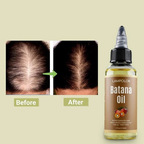 Aceite de batana para el crecimiento del cabello orgánico 100% natural puro ace - Picture 3 of 7