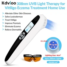 308nm Narrowband UVB Light Best Blue Light Therapy for Skin Diseases 6diodes