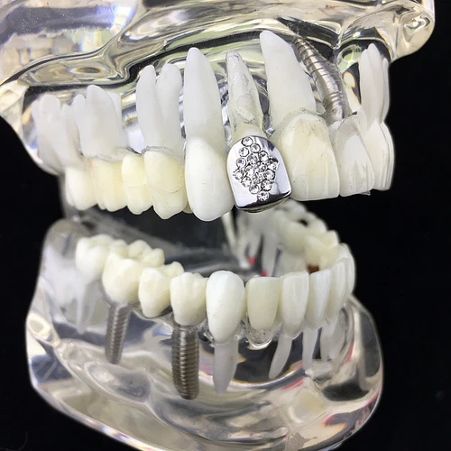 Diamante Design غطاء واحد الأسنان Grillz قبعة فضية واحدة محاكاة سبيكة CZ مثلج