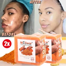 2x Tumeric Soap Acne Dark Spot Removal Skin Whitening Facial Body Bleaching Soap