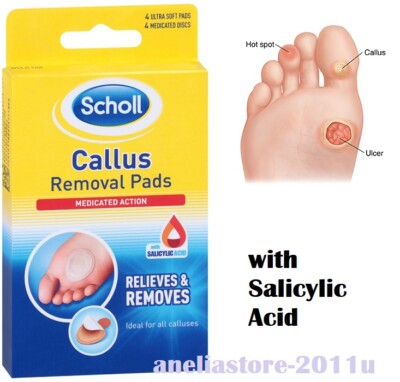 how to remove corn callus how to remove corn callus