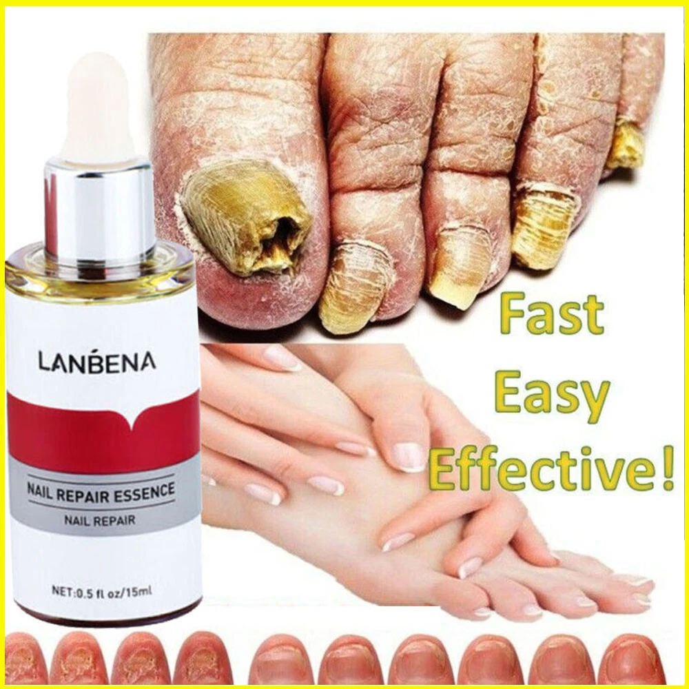 Discover 151+ essence nail polish remover best noithatsi.vn