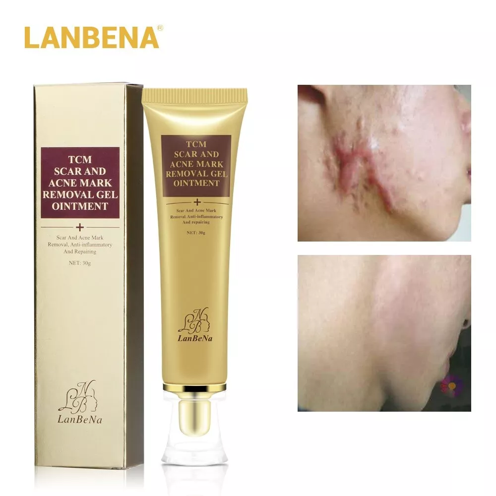 Best face scar removal cream deals