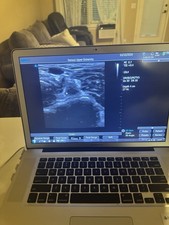 Vascular  Terason uSmart T3200 Ultrasound System W/Macbook and Software 