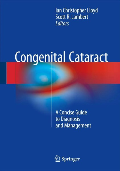 Ian Christopher Lloyd (U. A.) | Congenital Cataract | Buch | Englisch (2016)-image