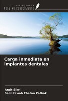 Carga Inmediata En Implantes Dentales Arpit Sikri