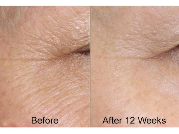 RETINOL + HYALURONIC ACID + VITAMIN C Anti-Aging Wrinkle Gel-Cream-Serum 3-Pack - Image 4 of 4