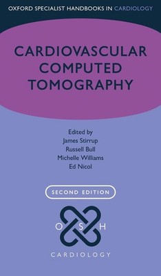 Cardiovascular Computed Tomography by James Stirrup (English) Paperback Book