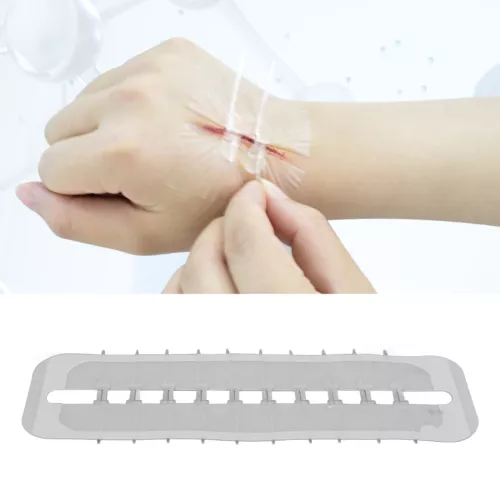 10x Emergency Wound Closures Adhesive Seamless Cuttable Hygienic Zip Stitch - Picture 13 of 23