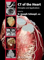 U. Joseph Schoepf | Ct Of The Heart | Taschenbuch | Englisch (2010) | Humana
