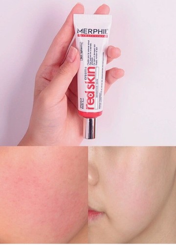 MERPHIL Red Skin Cream 30ml Redness Skin Care Acne & Blemish Treatment K-Beauty - Picture 7 of 9