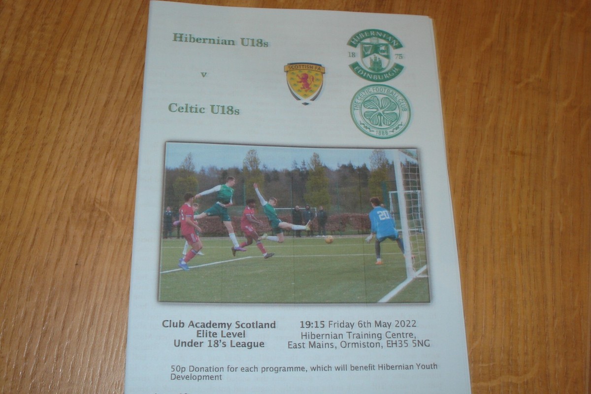 Celtic Fc Rangers V Hibs Radio Coverage HIBERNIAN (HIBS) U18'S V