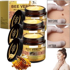 5X Bee Venom Skin Tag Removal Treatment Cream Body Care Mole Corn Wart Remover