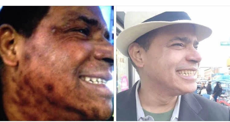 SKIN LIGHTENING TREATMENT:TRATAMIENTO EFECTIVO PARA BORRAR MANCHAS OSCURAS 2oz. - Image 4 of 4