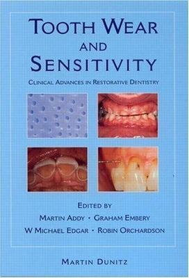 Tooth Wear and Sensitivity: Clinical Advances in Restorative Dentistry