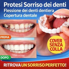 Protesi Sorriso dei denti Flessione dei denti dentiera Copertura dentale