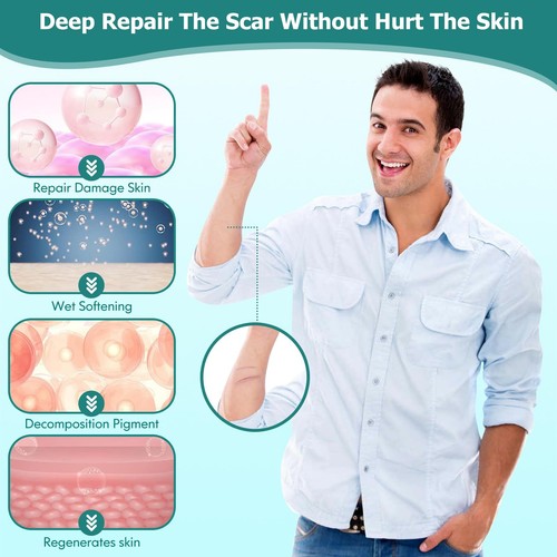 Scar Gel, Scar Cream, Advance Scar Gel For Surgical Scars,Face,Body,Leg, Burns - Picture 3 of 7