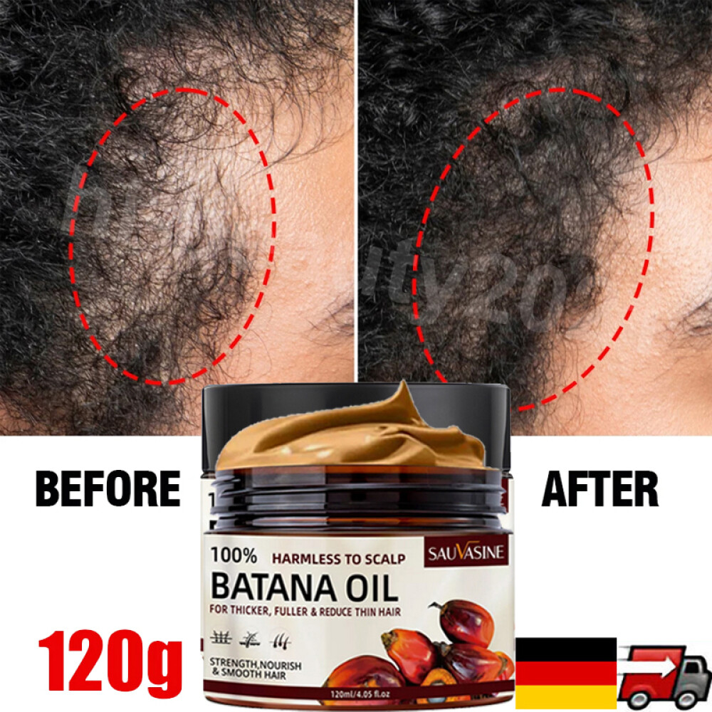 Batanaöl Für Haare - Biologisches Haaröl Für Wachstum, Feuchtigkeit & Reparatur, Für Männer & Frauen