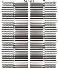 3/16 T316 Stainless Steel Cable Railing Hardware, System Kit, for Wood Posts, Sw