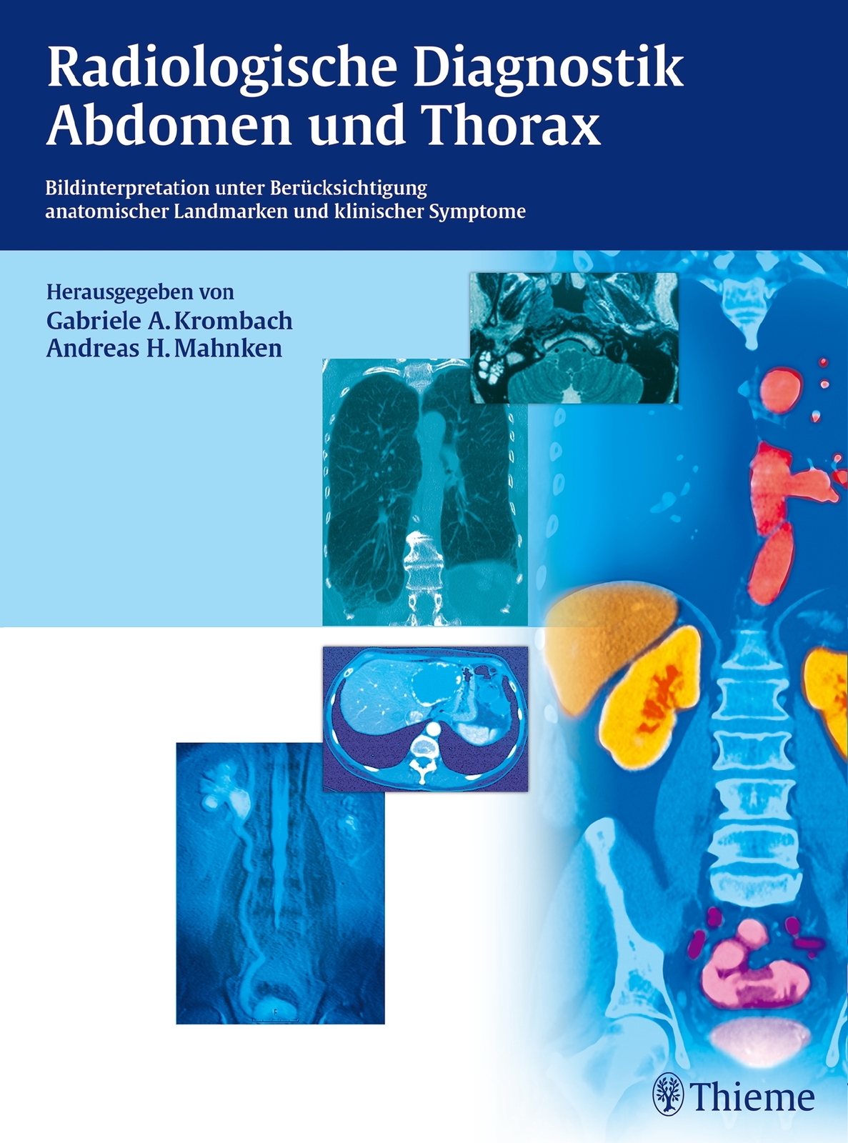 Thumbnail - Gabriele A. Krombach; Andreas H. Mahnken / Radiologische Diagnostik