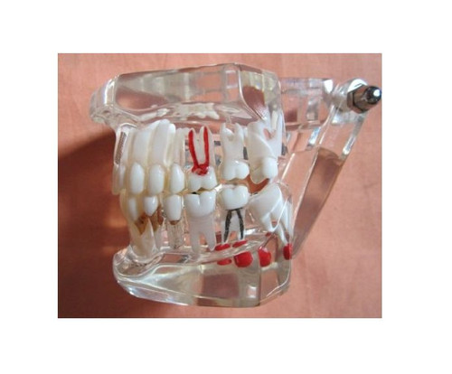 Dental Teach Study Adult Standard Typodont Demonstration Teeth Model #010 - Picture 3 of 6