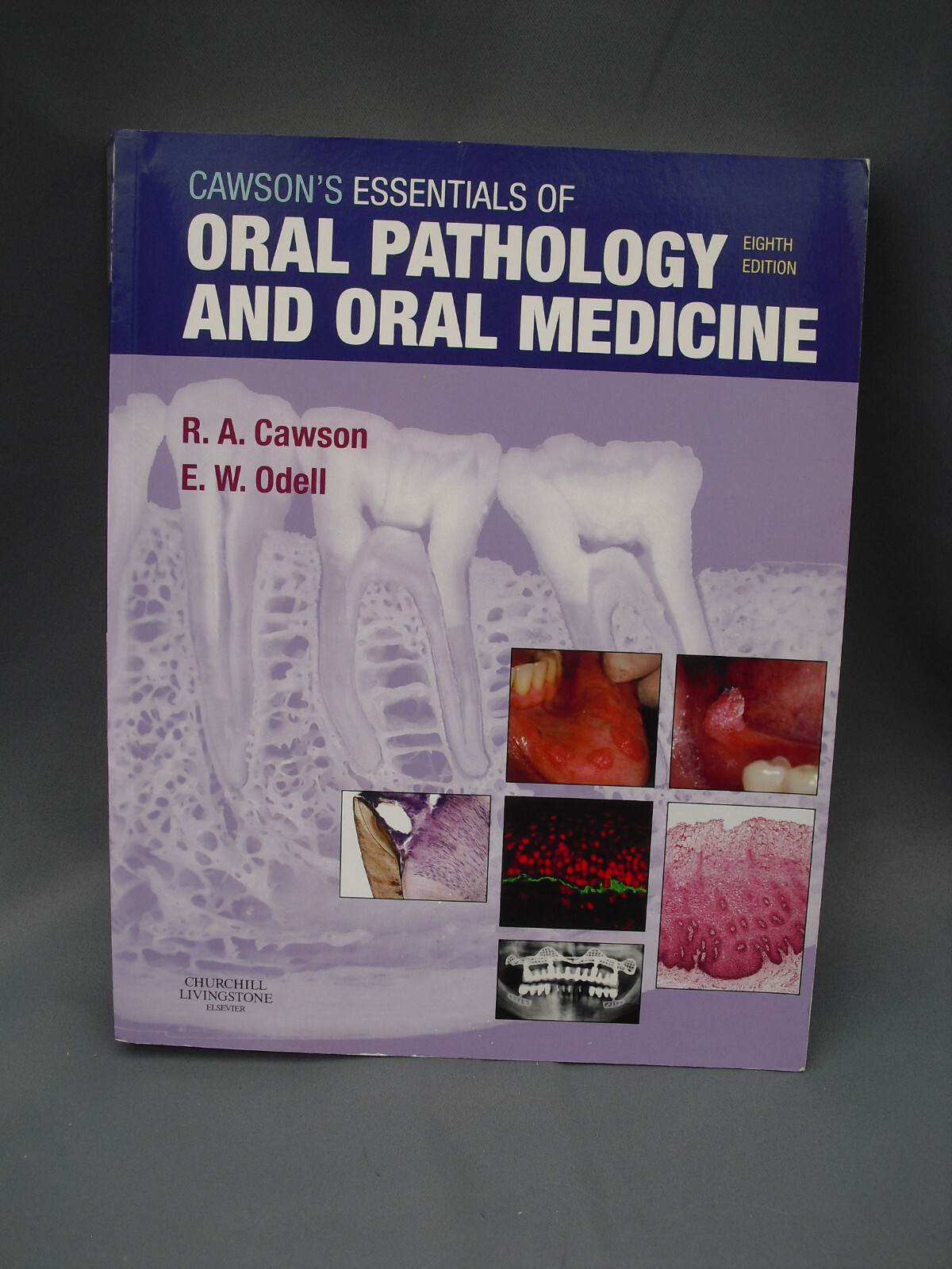 Cawson's Essentials of Oral Pathology and Oral Medicine by Edward W. Odell,...