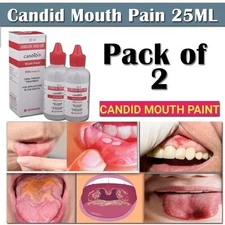 Candid Mouth Paint for Oral Thrush 25ml | Fast Fungal Infection Relief 2 PCS