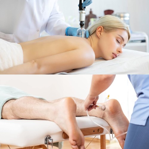 22-teiliges Akupunktursaugnapf Chinesisches Set für Therapie Cellulite Massage Massage.. - Bild 6 von 8