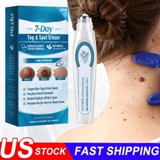 Tag  Spot Eraser Mole Skin Tags Removal Tool Eraser Pen Painless Long-Lasting