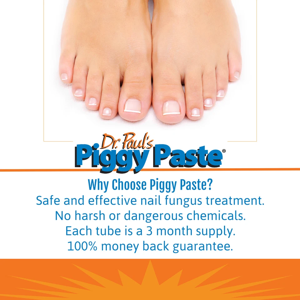Dr. Paul's Piggy Paste Gel Tratamiento de Hongos en Uñas Trata una Uña del dedo del pie durante 3 meses Foto 3 de 4