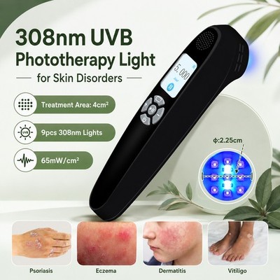 308nm Narrowband UVB Light Device 9 Diodes 4cm2 Rechargeable Home Skin Care Lamp