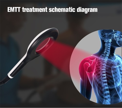 PEMF EMTT Physical Magnetic Physio Magneto Salon Equipment Pain Relief Machine - Picture 6 of 17