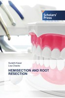 Hemisection And Root Resection Surabhi Kasar (U. A.) Taschenbuch Englisch 2024
