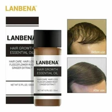 Unisex Lanbena Hair Loss Treatment Ginger Extract Hair Growth Essential Oil 20ml