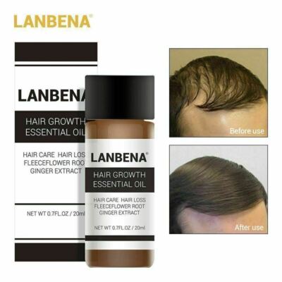 Unisex Lanbena Hair Loss Treatment Ginger Extract Hair Growth Essential Oil 20ml