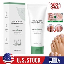 Nutraboost Nail Fungus Treatment Gel, Nail Fungus, Fungus Cream Natural  Gentle