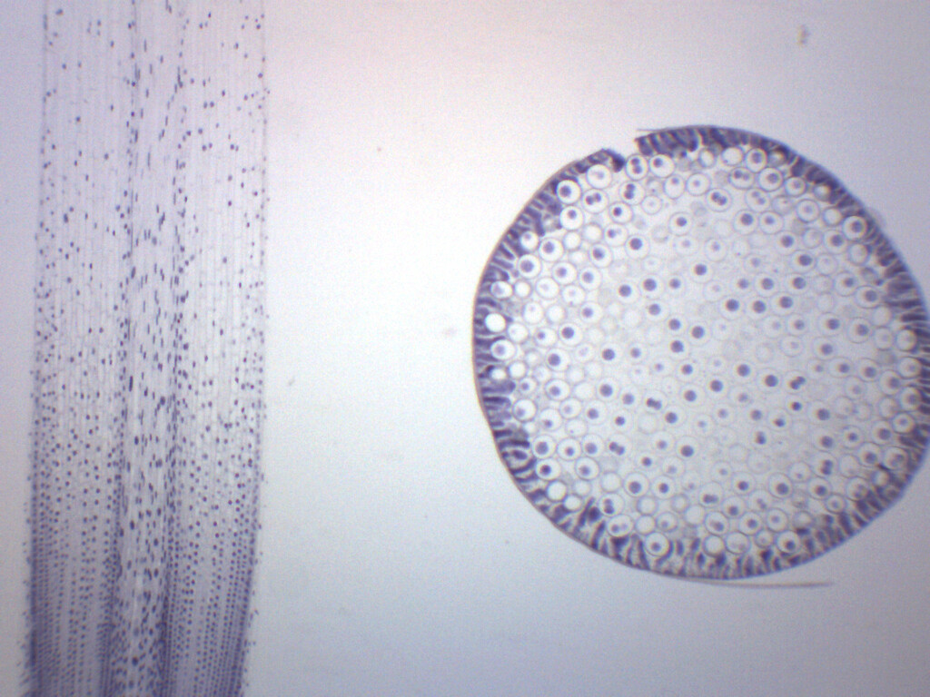Ascaris & Onion Mitosis, Prepared Microscope Slide - 75x25mm - Eisco Labs