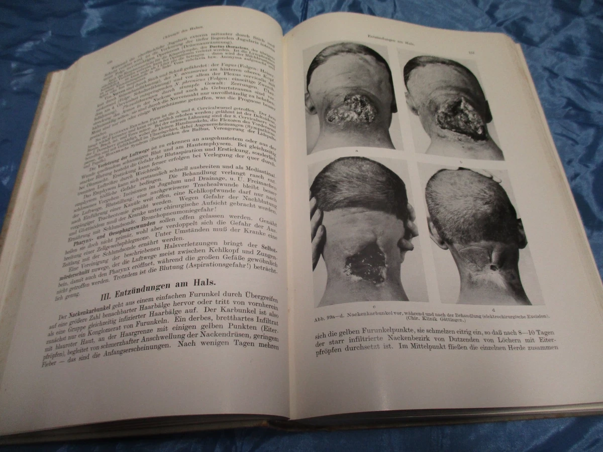 Chirurgie Vor 100 Jahren: G. Fischer - Étude Historique Sur La Médecine Au 18ème Siècle (Livre En Allemand)